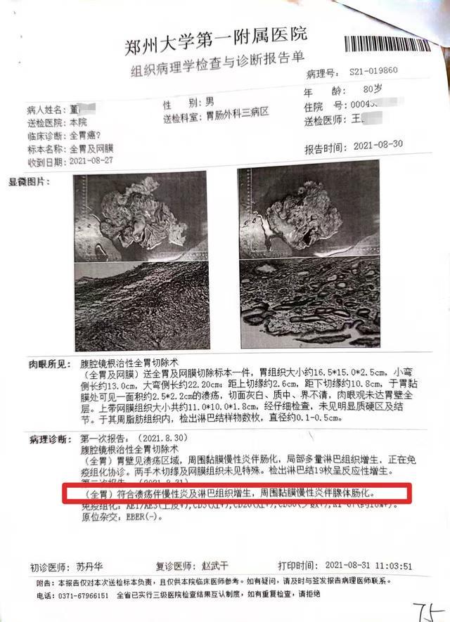 醫生左右不分把支架裝進正常輸尿管三名醫生醫療事故僅處罰一助手(圖6)