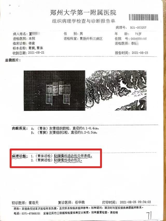 醫生左右不分把支架裝進正常輸尿管三名醫生醫療事故僅處罰一助手(圖5)